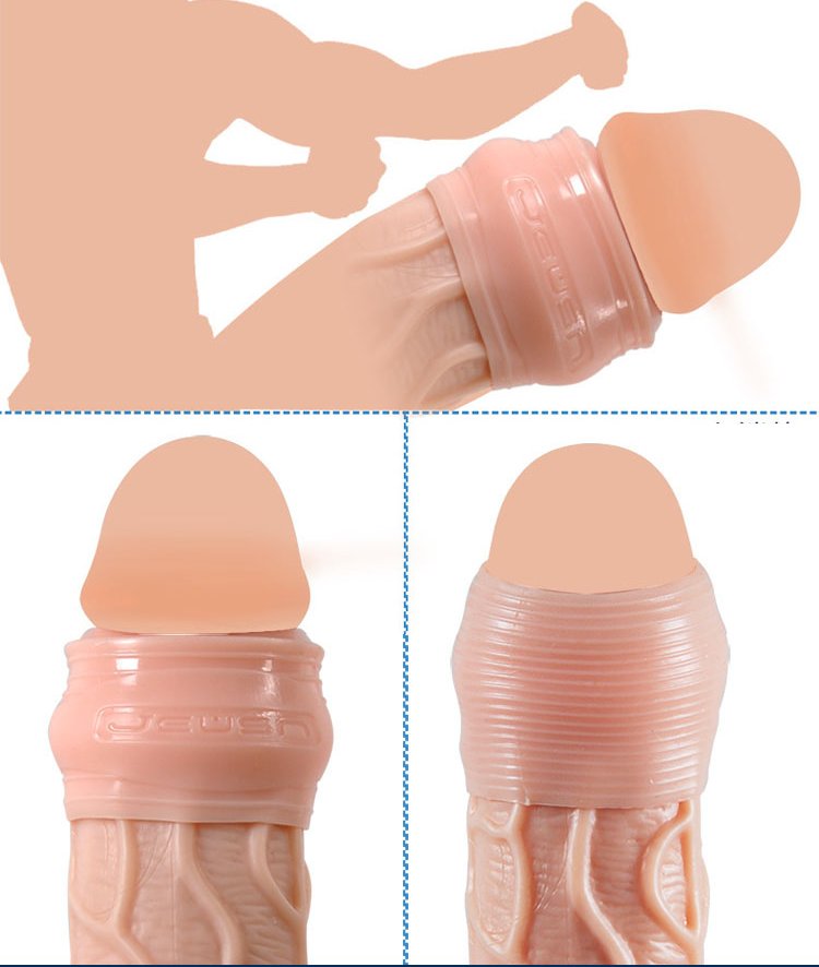 Bộ độn quy đầu ForeSkin cực kho&aacute;i &ndash; chất liệu silicone mềm dẻo, an to&agrave;n cho nam giới